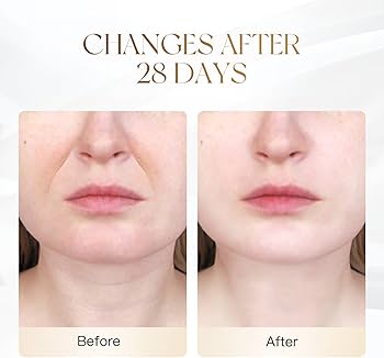 Wrinkle Remover Face Massager Slimming and Uplift Wand - Eye, Face, Neck Massage Roller, Double Chin Reducer